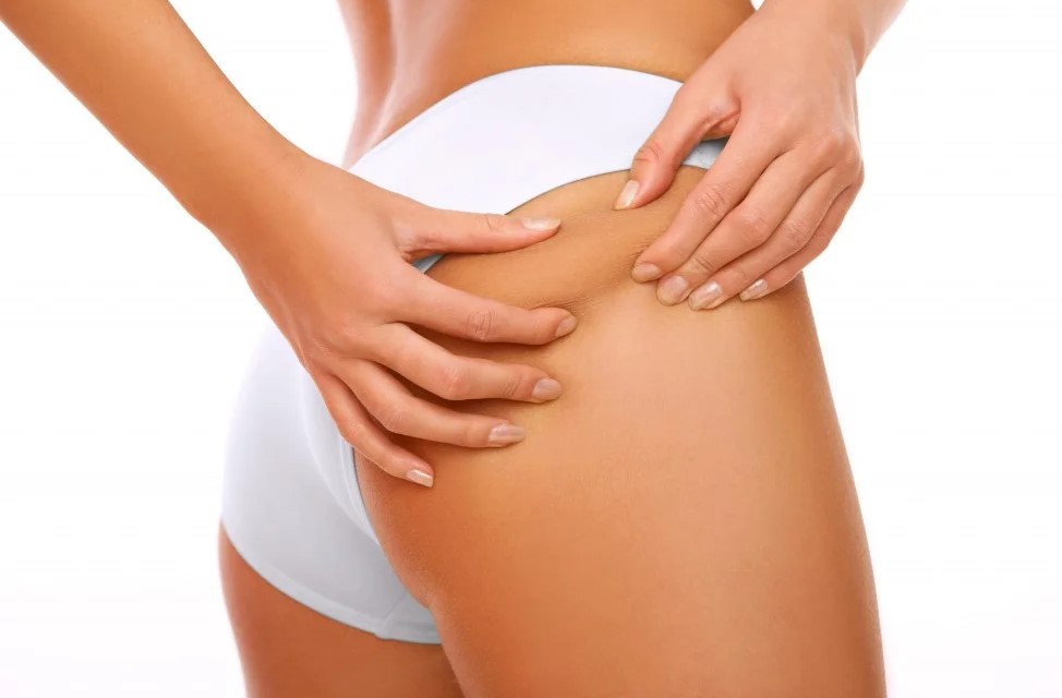 Bye bye celulitis